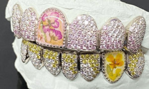 ASAP Rocky Flowers Grillz