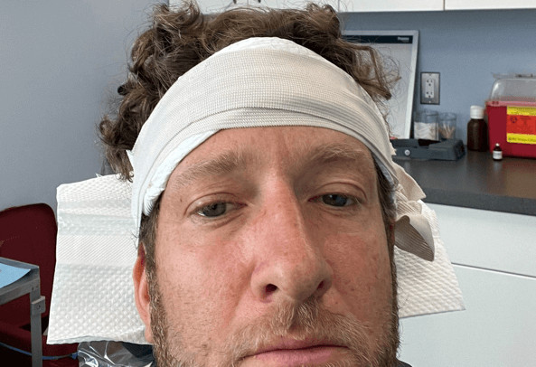 dave-portnoy-gets-hair-surgery-for-the-second-time-agoodoutfit